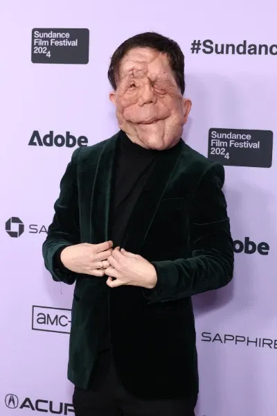 Adam Pearson photo