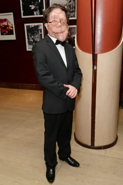Adam Pearson photo