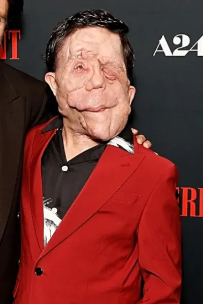 Adam Pearson photo