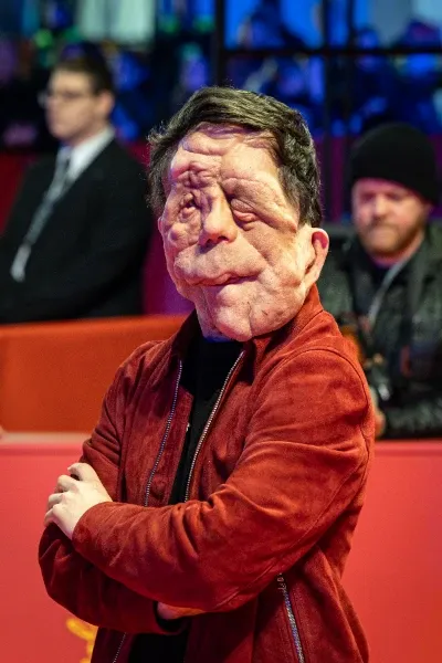 Adam Pearson photo