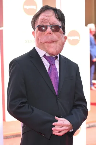 Adam Pearson photo