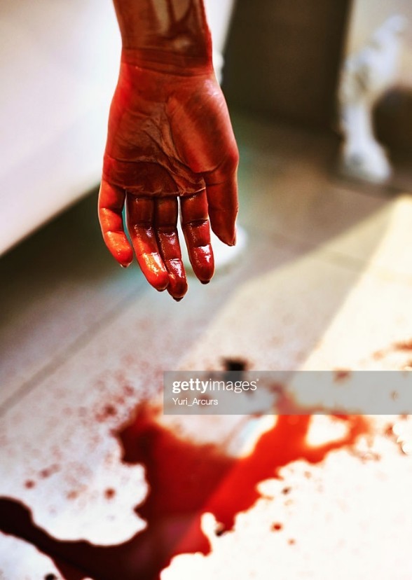 Dead By My Lover