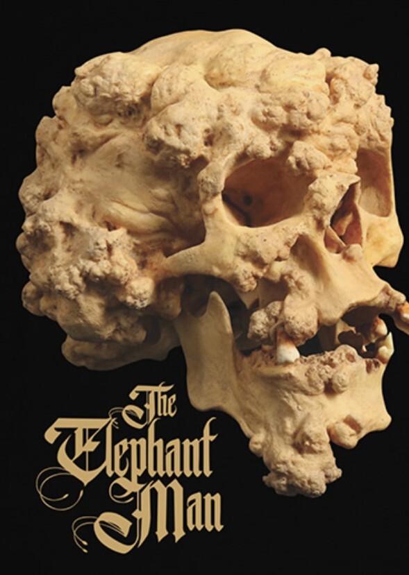 Elephant Man