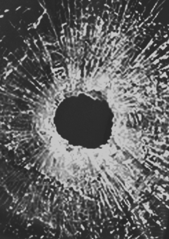 Every Breath Is A Bullet