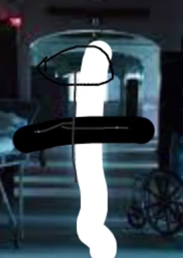 Kidney