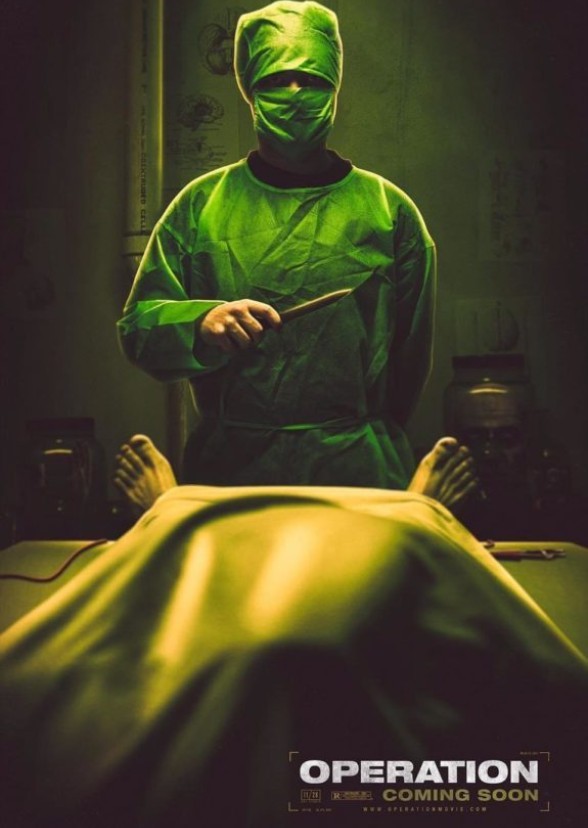 Operation