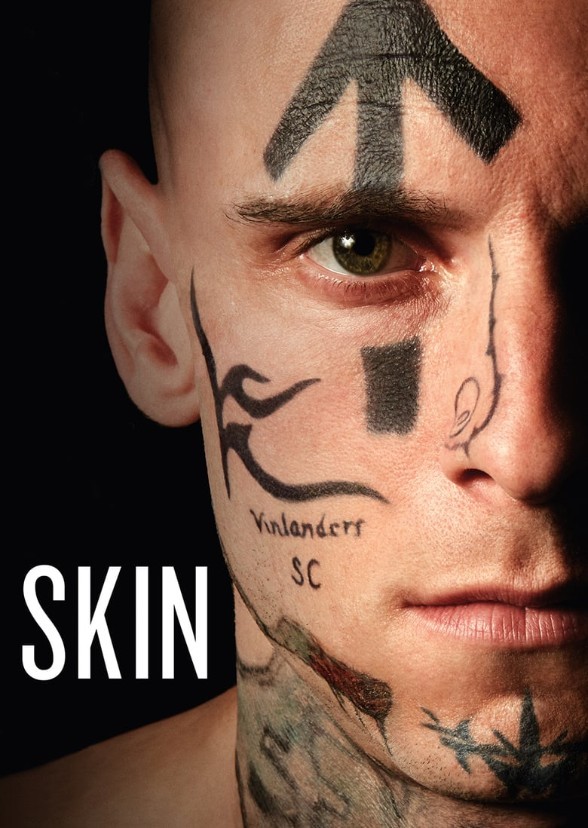 Skin (TV Show)