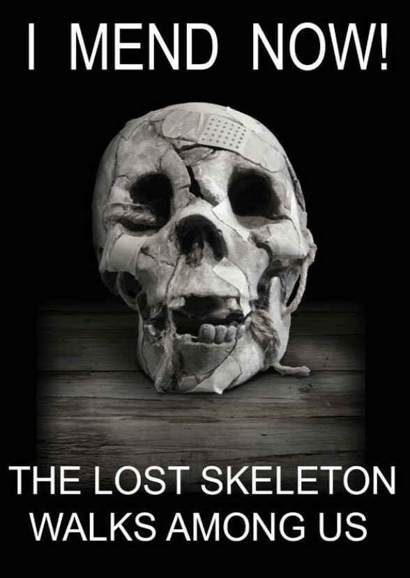 The Lost Skeleton Walks Among Us