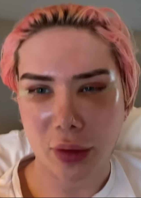 Ugly Man